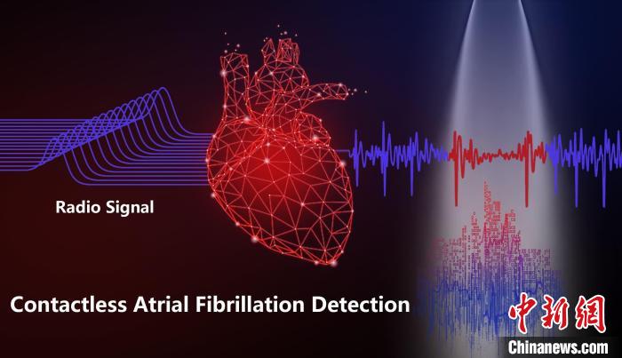 現金網：中國團隊研發出非接觸式房顫檢測系統 助心律失常早發現早乾預
